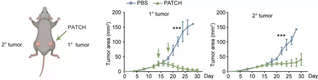 免疫治疗重要突破:我国科研人员开发出可精准识别癌细胞的“纳米标记机器人”