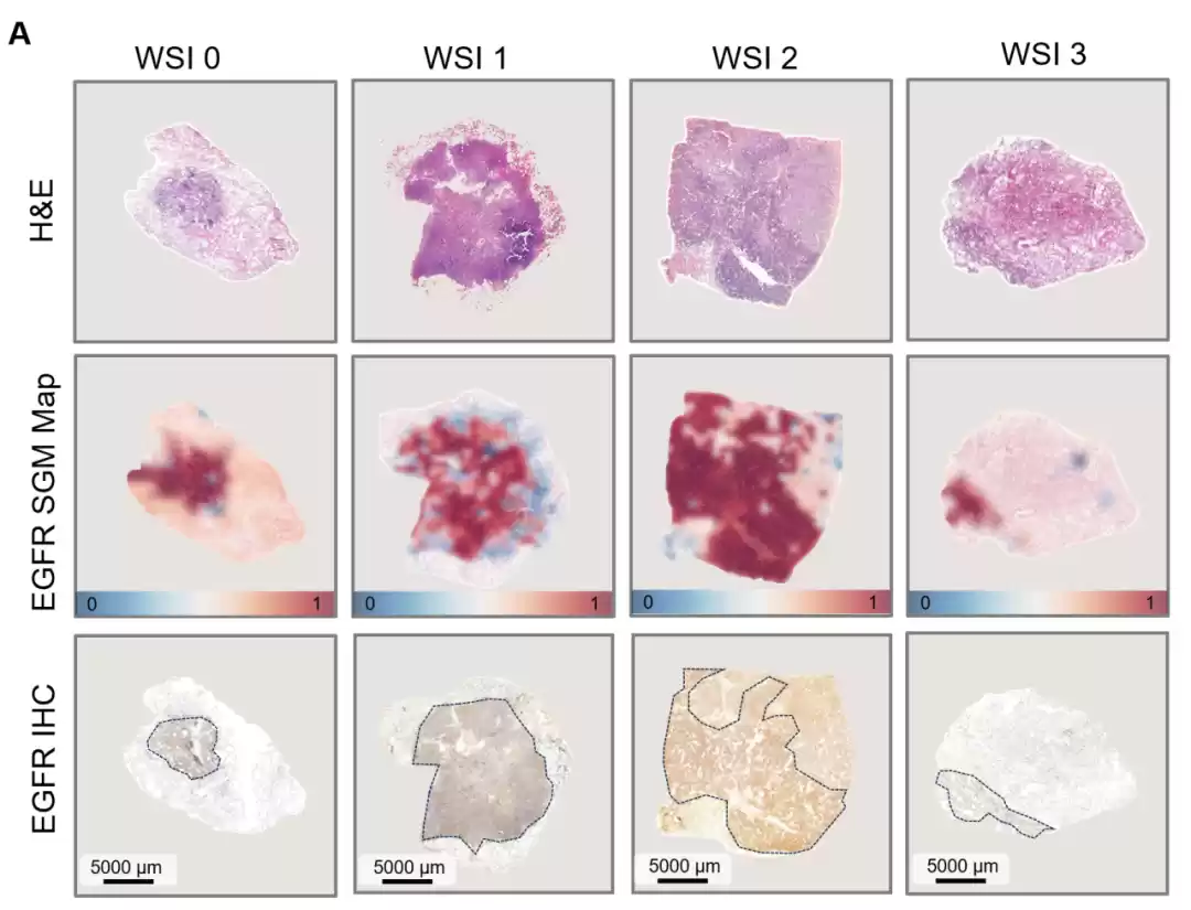 腾讯DeepGEM病理大模型