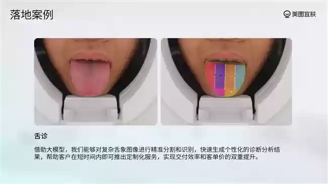 美图宜肤推动测肤服务从“一次性服务”迈向“长期资产”