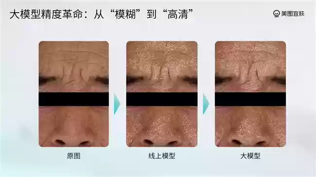 美图宜肤推动测肤服务从“一次性服务”迈向“长期资产”