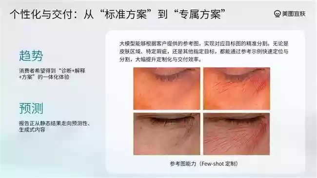 美图宜肤推动测肤服务从“一次性服务”迈向“长期资产”