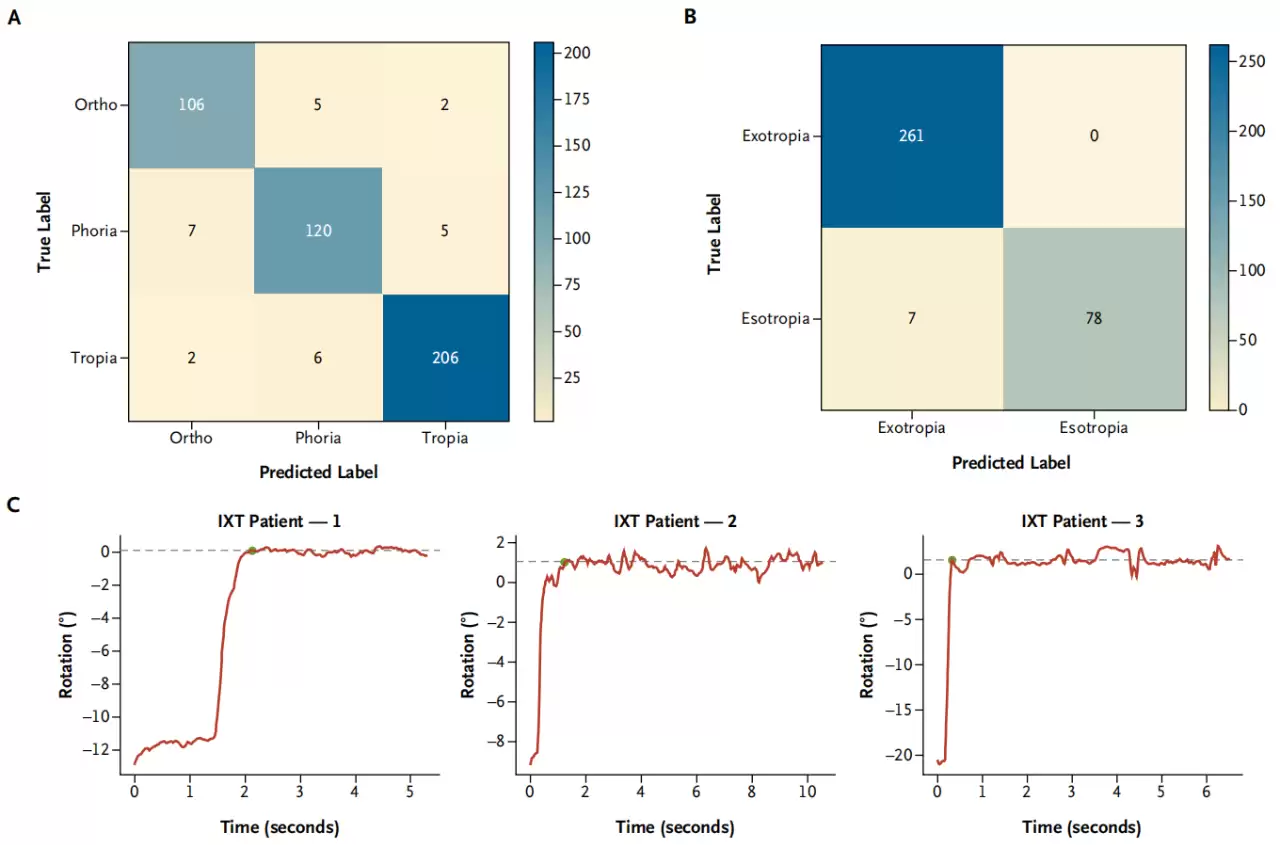我国科学家研发新技术：智能手机 30 秒测斜视