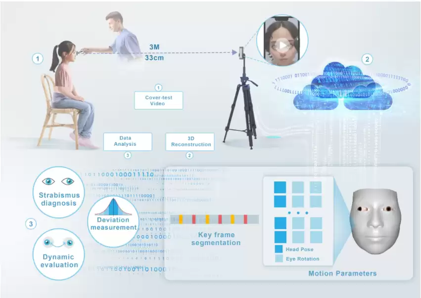 我国科学家研发新技术：智能手机 30 秒测斜视