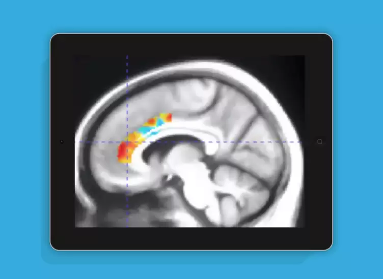 认知训练游戏可延缓大脑衰老十年