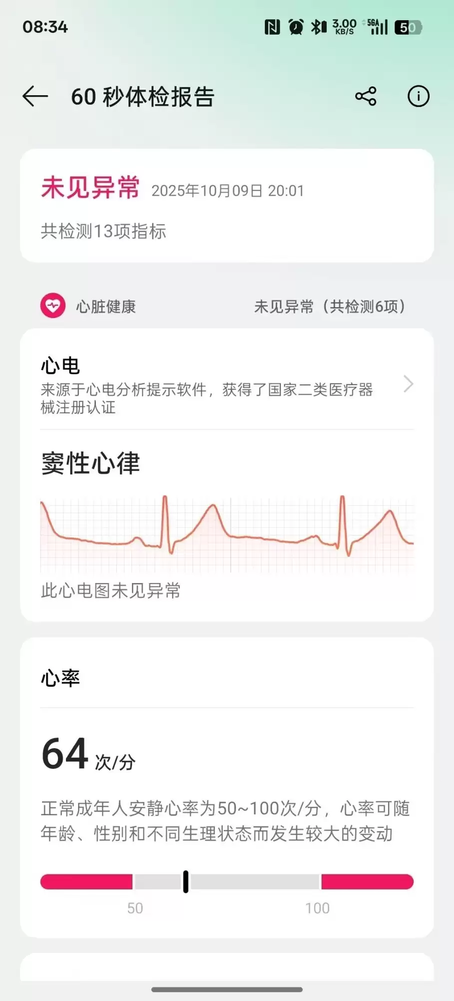 轻薄表皇消灭吃灰 双十一OPPO Watch S仅售1499元