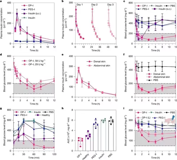 糖尿病告别打针 浙大团队实现无创透皮给药