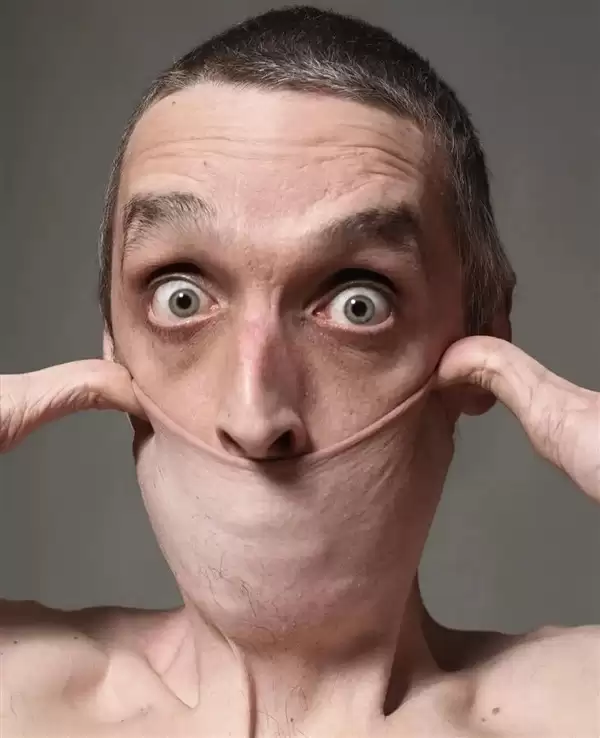 加里·特纳：皮肤可拉伸15.8厘米的活体橡皮人