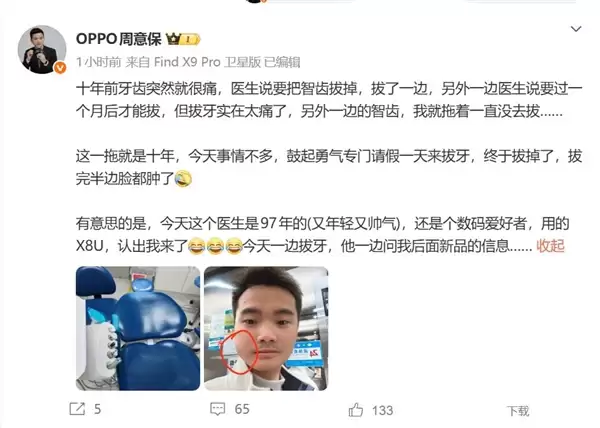 OPPO周意保去拔牙 牙医是O粉：一边拔牙一边问新机消息