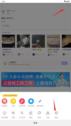 牙匠之家app动态删除方法