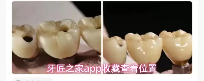 牙匠之家app收藏查看位置