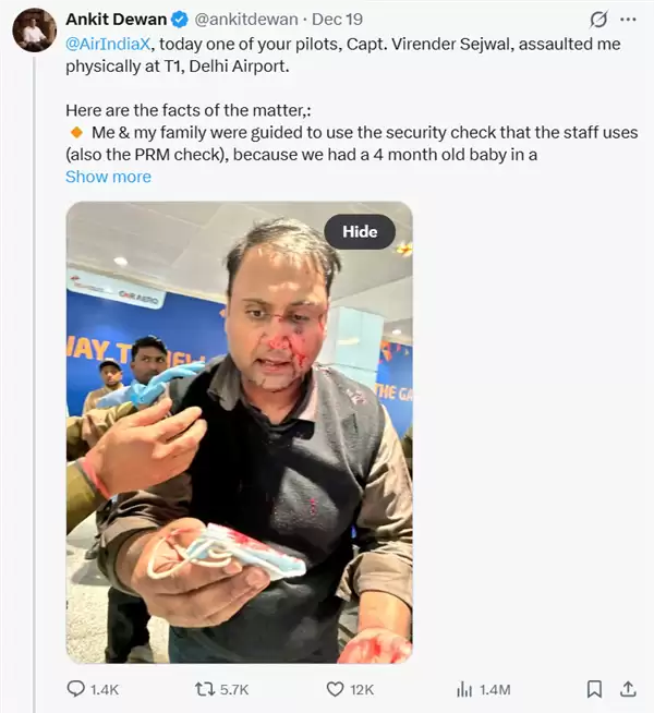 离谱!印度一机长机场安检时插队 争执后殴打乘客