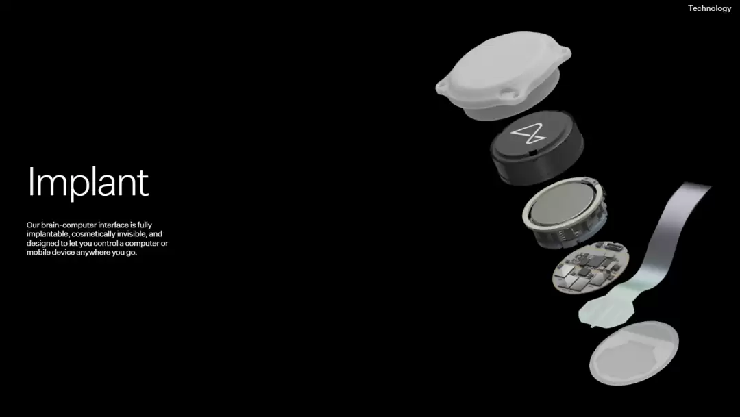 马斯克脑机接口“一号受试者”：正重新夺回人生的独立