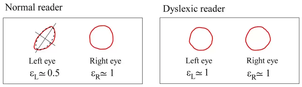 Abeye 推出 Lexilens 23.8 英寸显示器:专为阅读障碍人士设计,1080P 、144Hz