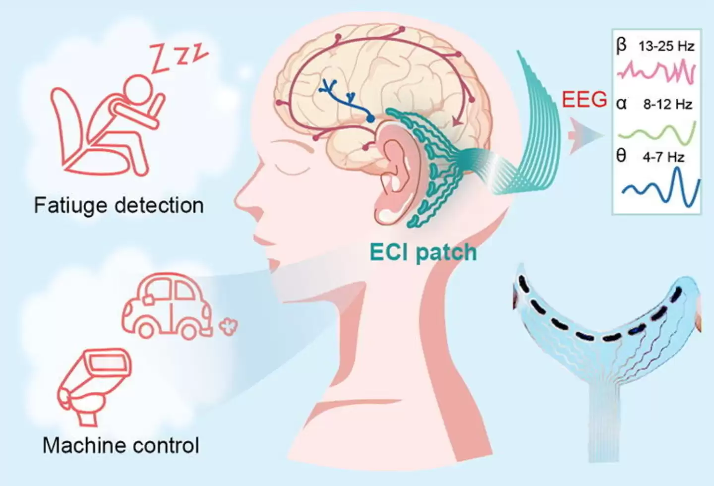 耳后脑机接口贴片问世:北理工、北航团队打造,连续佩戴10小时稳定使用