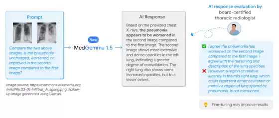 谷歌发布医疗 AI 模型 MedGemma 1.5 4B：可本地部署，CT、MRI 都能处理