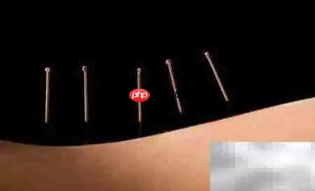 针灸注意事项须知