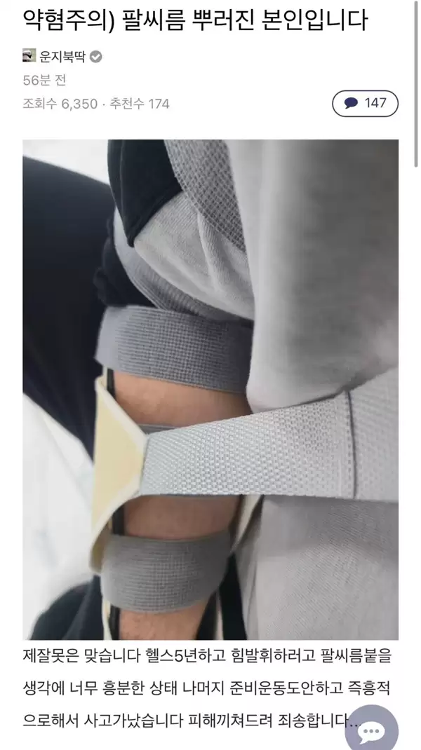 韩国玩家挑战《鸣潮》吉祥物椿:比赛掰手腕没曾想直接骨折!