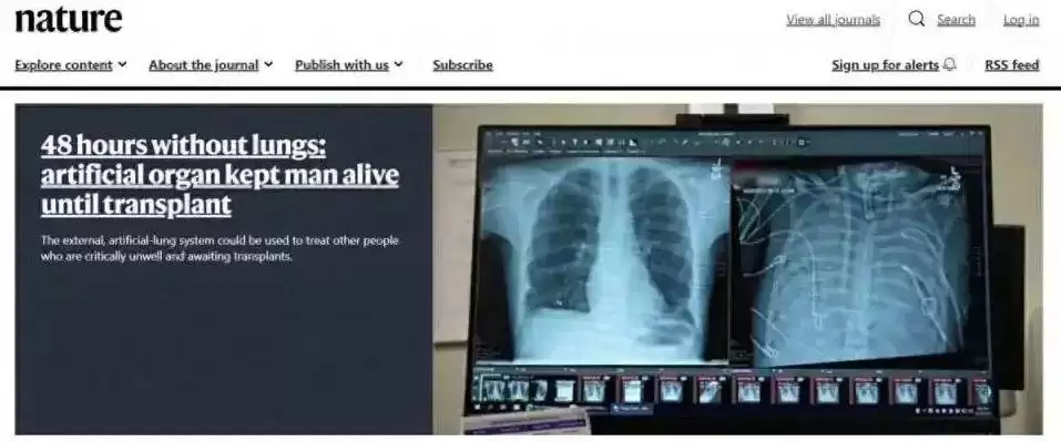 美团队研发新型人工肺，实现患者无肺生存48小时并成功移植
