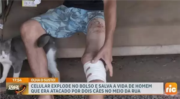 巴西男子被两条狗狂咬 手机突然爆炸救了他一命