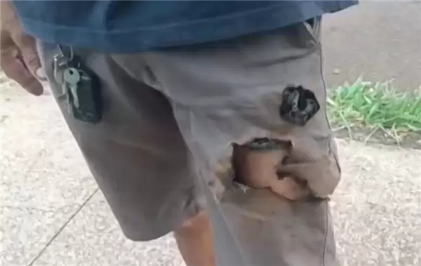 巴西男子被两条狗狂咬 手机突然爆炸救了他一命