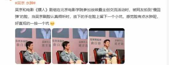 “吴京水肿”登热搜：脸上一按一个坑