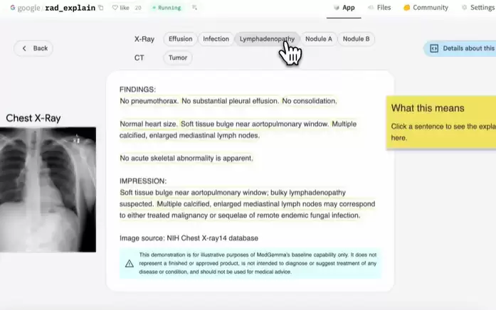 谷歌重磅发布三大Gemma模型变体,AI医疗、手语翻译与海豚语言解锁新可能! 谷歌重磅发布三大Gemma模型变体,AI医疗、手语翻译与海豚语言解锁新可能!