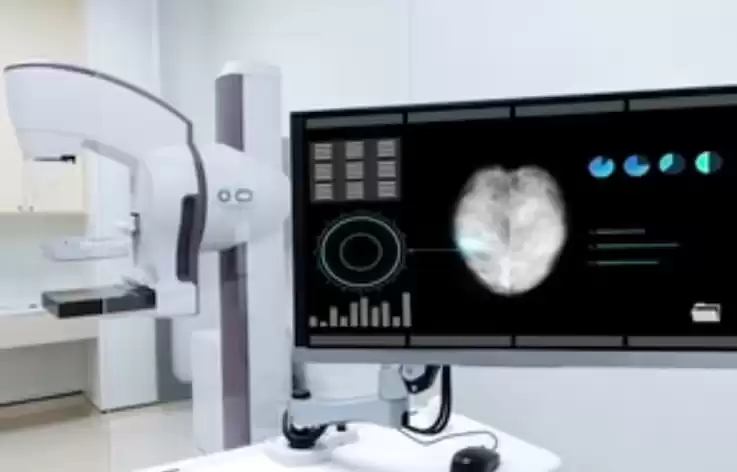 英国启动 70 万人全球最大规模乳腺癌 AI诊断实验，有望解放数百名医生