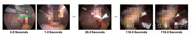 全球首个医疗视频理解大模型开源！6k+组精标测试集与英雄榜同步上线，开发者速来！