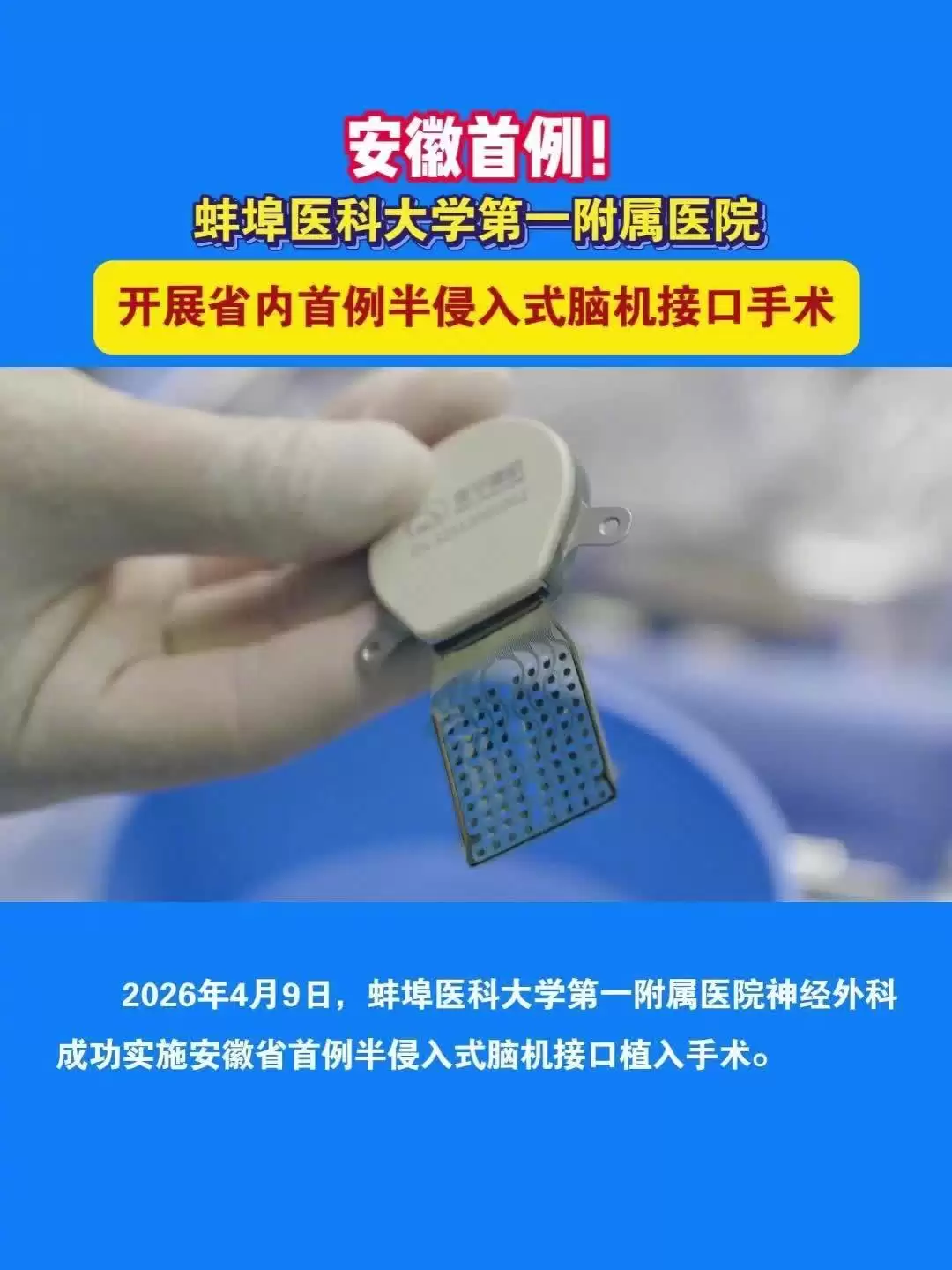 安徽省首例半侵入式脑机接口植入手术成功