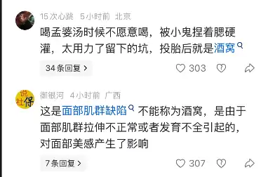 女子酒窝大被网友质疑是AI特效 本人：是真的  一直都被人说大