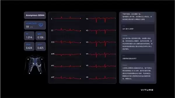 让传统纸质心电图“活”起来！VITURE携手智源研究院发布全新XR AI 数字医疗应用