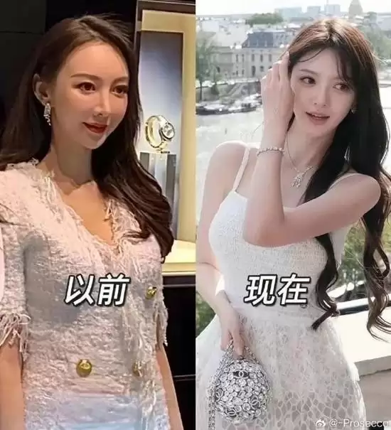 叶珂自曝“全身do了” 全身上下嫩肤+微调
