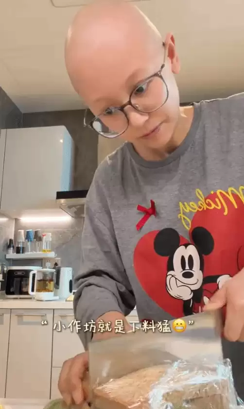 最后一次化疗在即!一栗小莎子光头出镜 乐观治癌