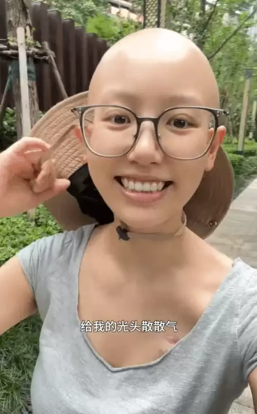 最后一次化疗在即!一栗小莎子光头出镜 乐观治癌