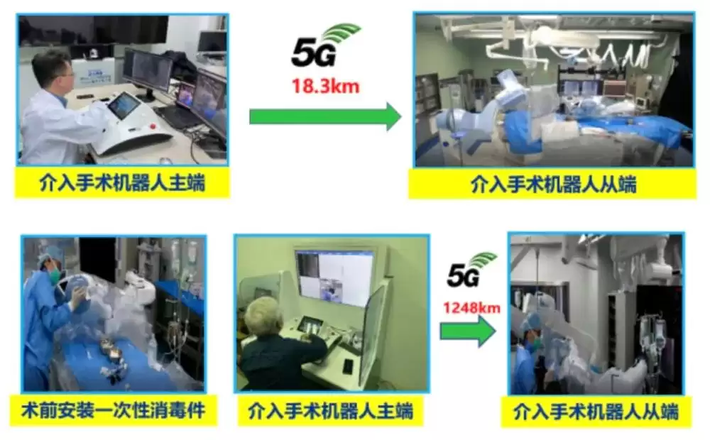 VasCure血管介入机器人5G远程Culotte支架术
